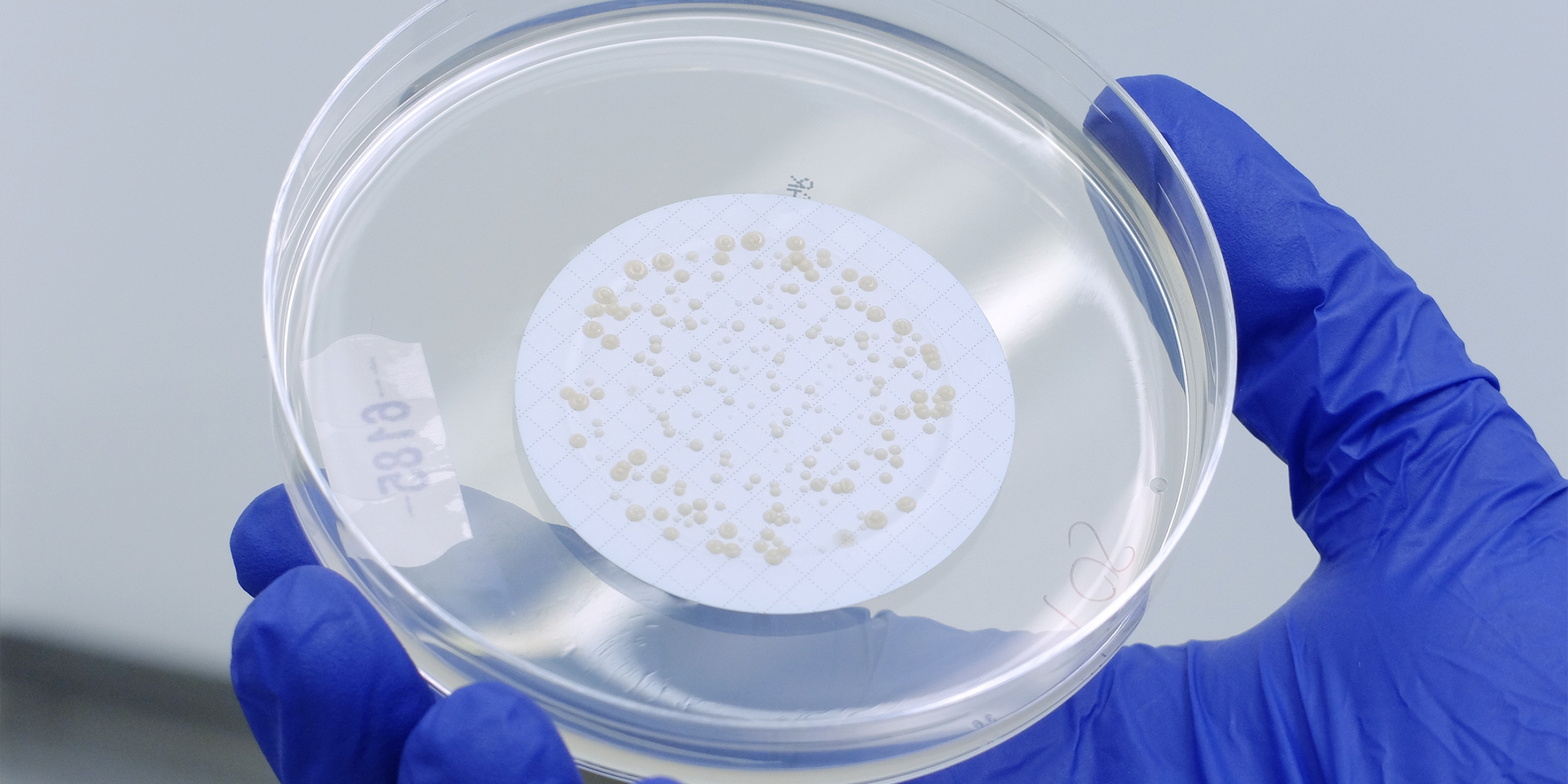 Environmental Mycobacteria test plate